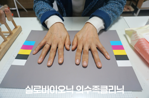 컬러차트 위에 두 손을 올린 실리콘 손가락 의수 착용 모습