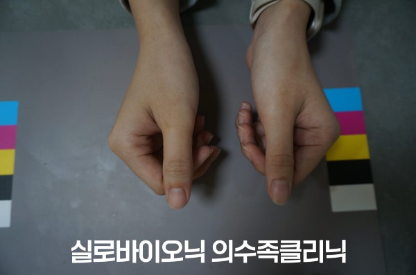표준 컬러차트 옆에서 두 엄지를 세운 모습, 한쪽 엄지에 실리콘 손가락 의수를 착용