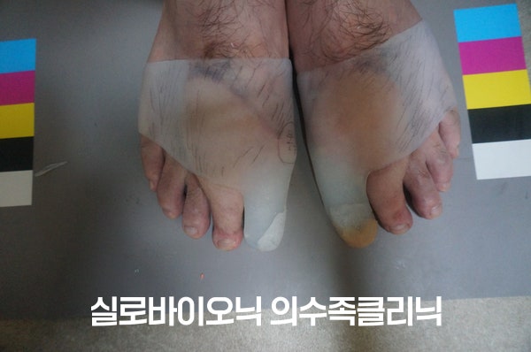 양발 앞쪽에 반투명한 체크소켓을 끼운 모습
