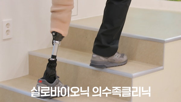 하퇴 의족을 착용하고 계단을 오르는 모습