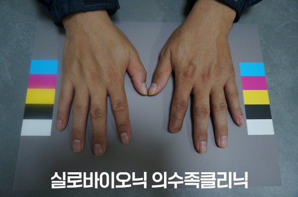 표준 컬러차트 위에 나란히 올린 고객님의 두 손