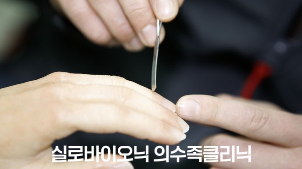 가는 도구로 실리콘 손가락 의수의 손끝을 다듬는 모습