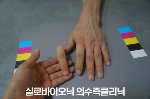 완성된 검지 실리콘 의수를 고객님 손 옆에 들어 보이는 모습