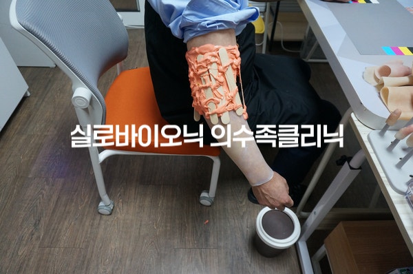 팔뚝에 본뜨기 재료를 붙여 형태를 뜨는 모습