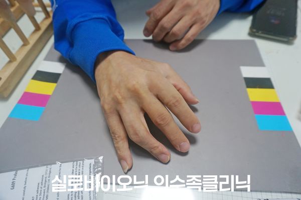 표준 컬러차트 위에 부분 손 실리콘 의수를 착용한 손