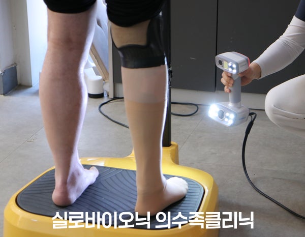 핸드 스캐너로 다리 형태를 3D 스캔하는 모습