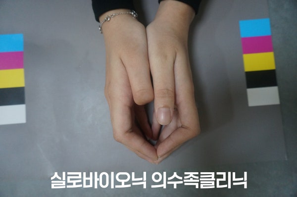 표준 컬러차트 위에서 두 손을 모은 모습, 한쪽 엄지 끝마디가 없는 착용 전