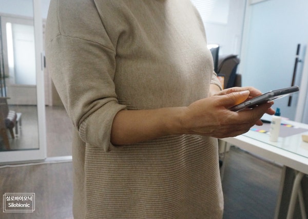 실리콘 전완 의수를 착용하고 휴대전화를 든 모습