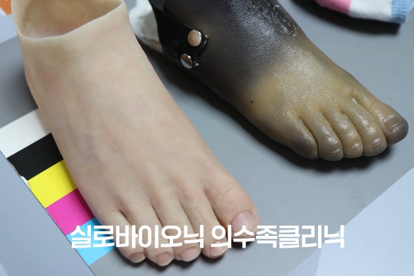 표준 컬러차트 위에 나란히 놓인 새 실리콘 발 의족과 검게 변한 PVC 발 의족