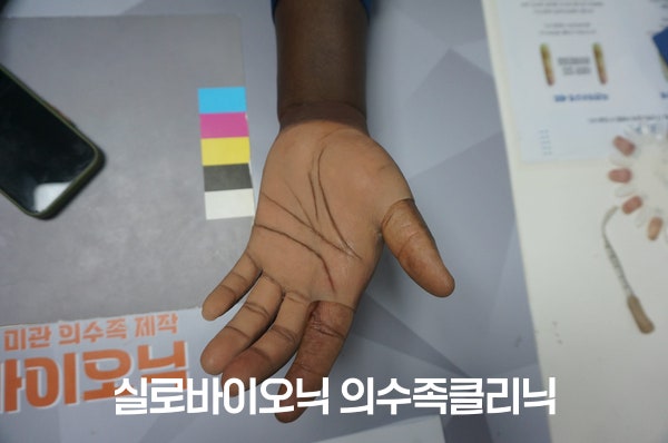컬러차트 옆에서 손바닥을 편 손, 짙은 손목과 밝은 손바닥 색이 이어진 의수 착용