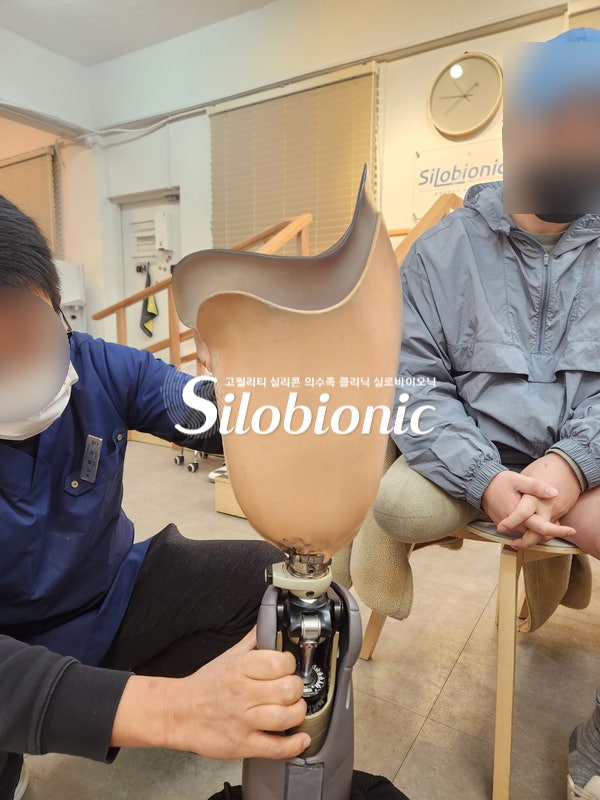 클리닉에서 제작자가 무릎 부품이 달린 대퇴 의족 소켓을 조정하는 모습