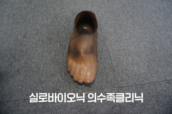 오래 사용해 갈색과 검은색으로 얼룩진 PVC 발 의족