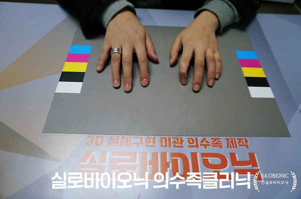 같은 컬러차트 위에서 실리콘 손가락 의수를 착용한 두 손