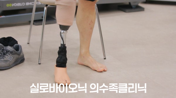 의자에 앉은 고객님이 착용한 하퇴 의족과 실리콘 발