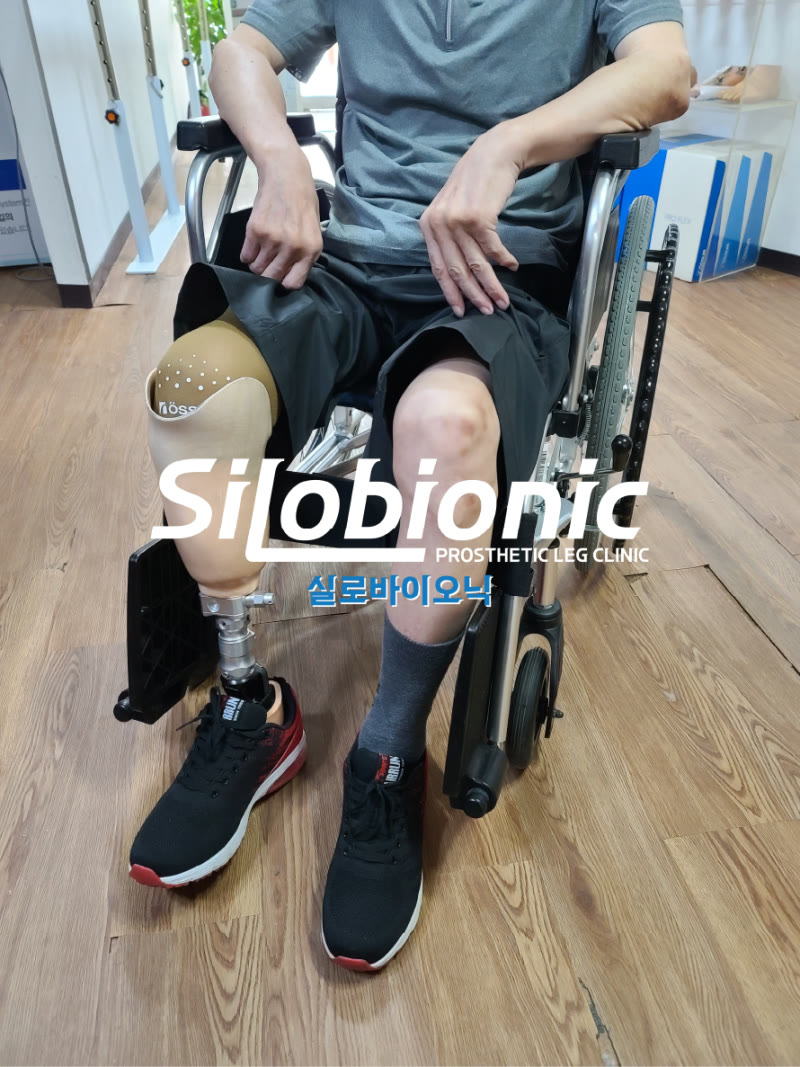 휠체어에 앉아 무릎 위 절단용 의족을 착용한 모습