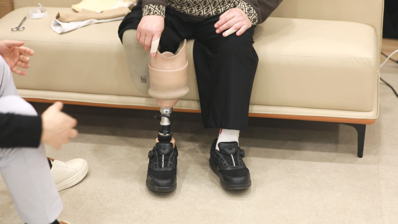 소켓과 금속 연결부로 된 하퇴 의족을 착용하고 앉아 있는 모습
