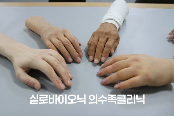 회색 테이블 위에 놓인 여러 실리콘 손 의수 샘플