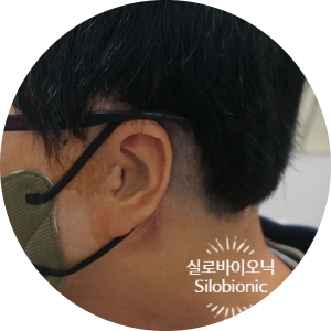 안경다리와 마스크 끈을 함께 건 실리콘 귀 옆모습