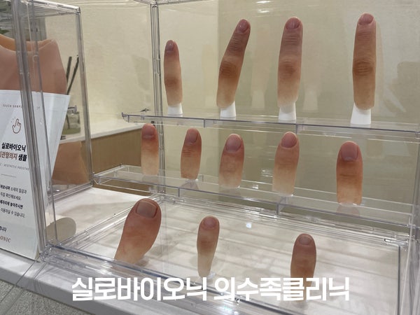 진열장에 보관된 실리콘 손가락 의수 샘플들