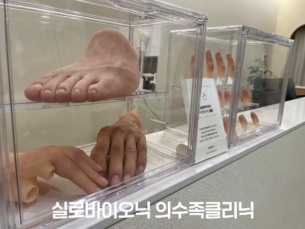 클리닉에 진열된 실리콘 의족과 의수 샘플