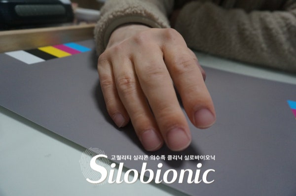 컬러차트 위에 올린 실리콘 손 의수 착용 모습