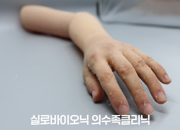 물방울이 맺힌 실리콘 손 의수