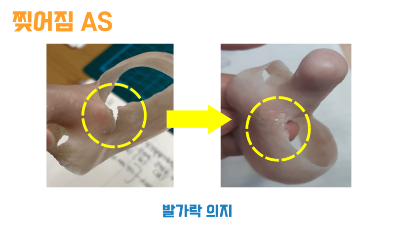 모서리가 찢어진 실리콘 발가락 의지와 수리한 뒤의 모습 비교