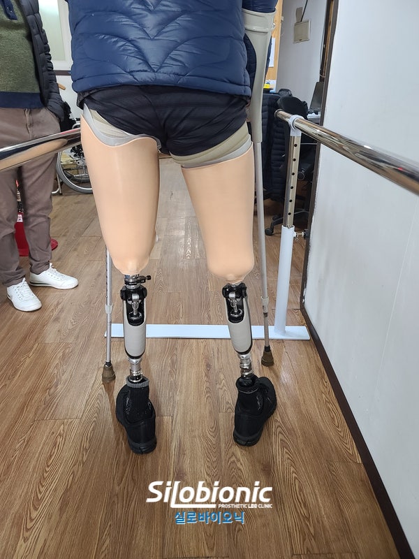 평행봉 사이에서 양쪽 대퇴 의족으로 서 있는 뒷모습