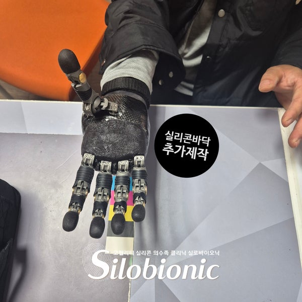 손바닥 쪽에 실리콘 바닥을 더한 티타늄 반자동 의수