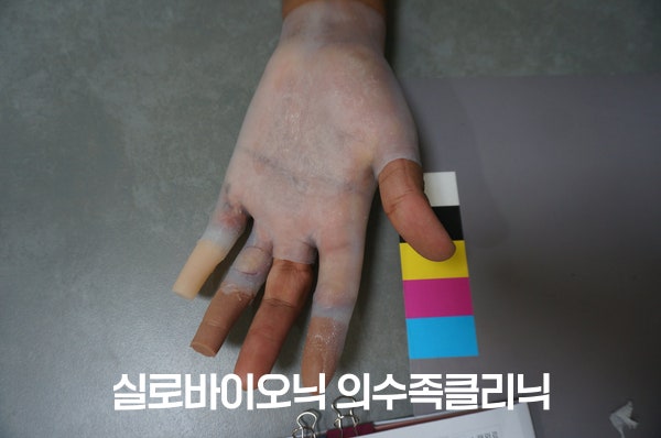 반투명 임시 소켓을 손에 끼고 컬러차트 옆에 놓은 모습