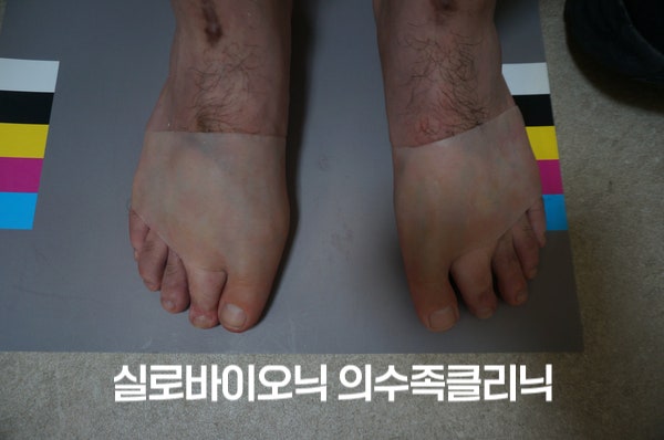 표준 컬러차트 위 두 발, 양쪽 엄지발가락 자리에 실리콘 의족 착용