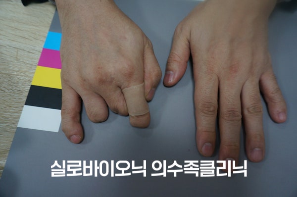표준 컬러차트 옆 두 손, 오른손 약지가 짧고 밴드를 감은 모습