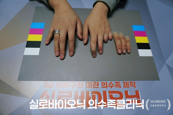 표준 컬러차트 위에 놓인 두 손과 옆에 둔 실리콘 손가락 의수