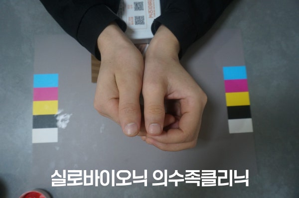 표준 컬러차트 위에서 두 엄지를 모은 손, 한쪽은 실리콘 손가락 의수