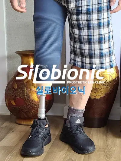 의족 고정 방식, 핀·흡착(씰인)·진공·슬리브는 무엇이 다르고 누구에게 맞나요?