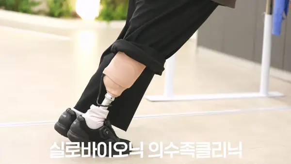 의족으로 뛰거나 운동하고 싶다면, 어떤 발을 비교해 볼까요?